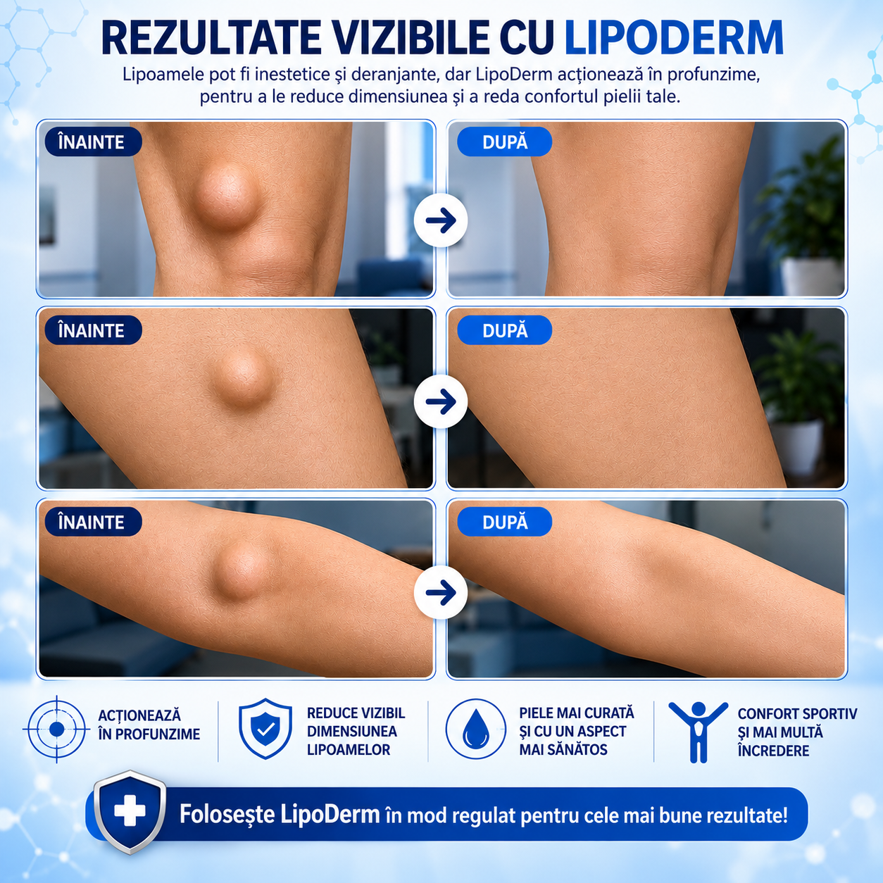 LipoDerm Crema pentru Lipoame